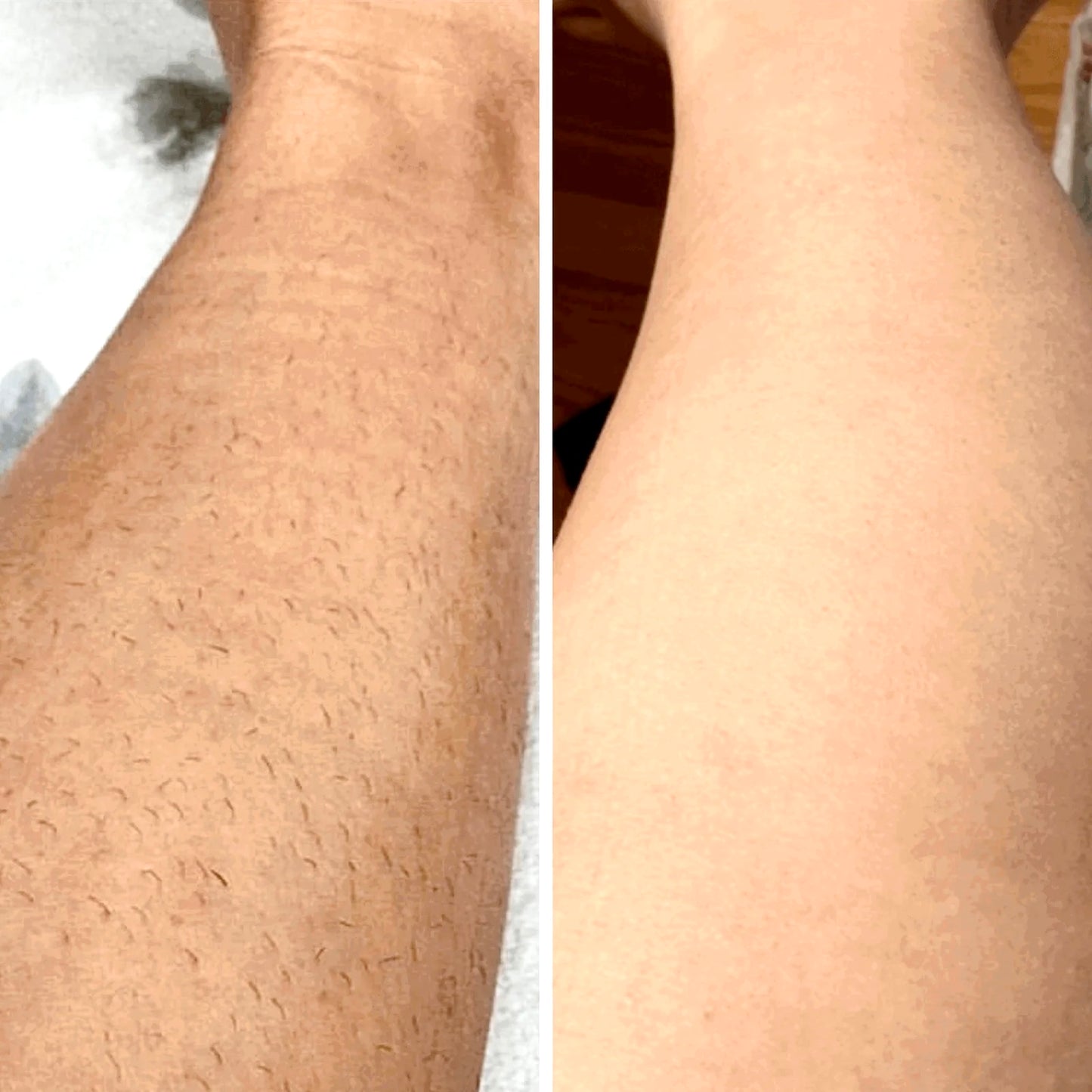 IPL Hair Removal PRO MAX