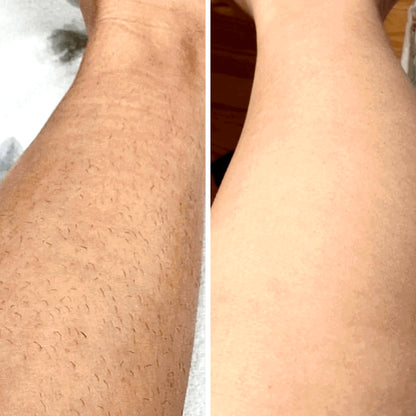 IPL Hair Removal PRO MAX